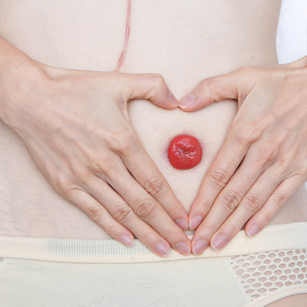 Ostomy