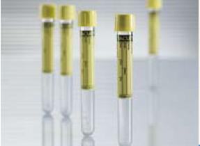 Vacuette® Urinalysis Tube, 6 mL, 13 x 100 mm