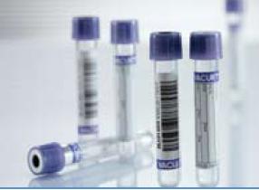 Vacuette® Venous Blood Collection Tube, 2 mL, 13 x 75 mm