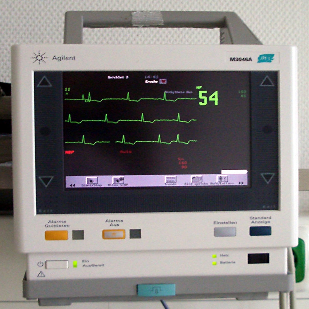 ECG Monitor