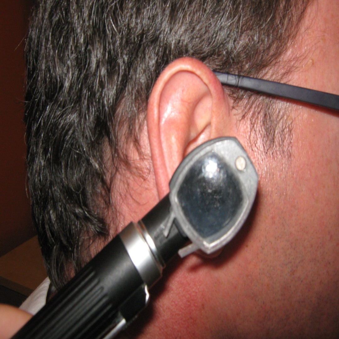 Otoscope