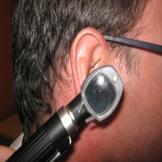 Otoscope