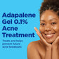 Differin Gel Acne Treatment