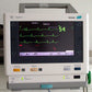 ECG Monitor