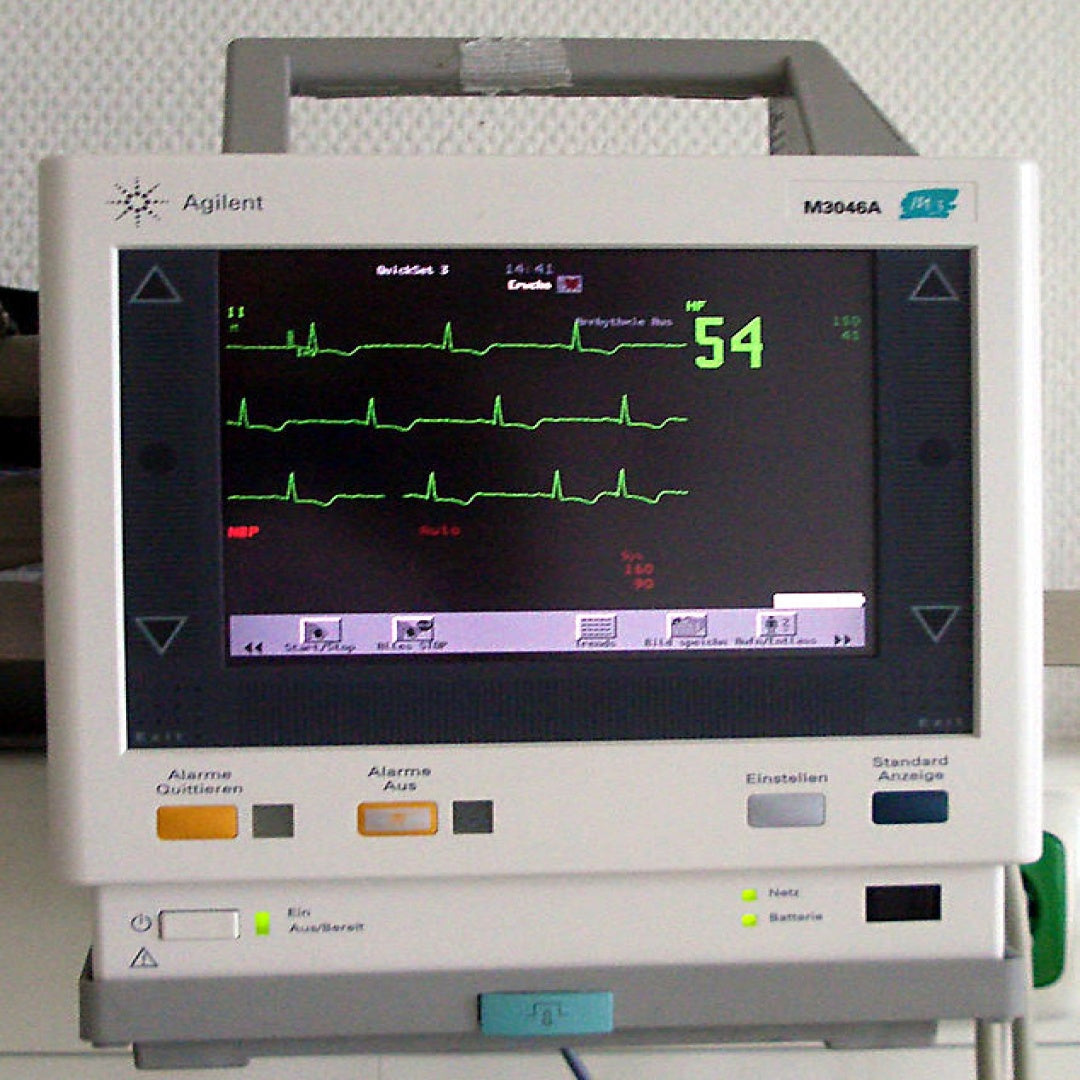 ECG Monitor