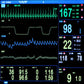 ECG Monitor