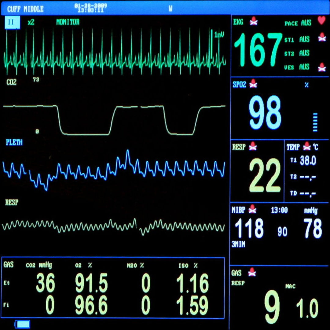 ECG Monitor